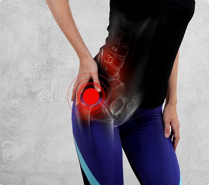 hip pain diagram