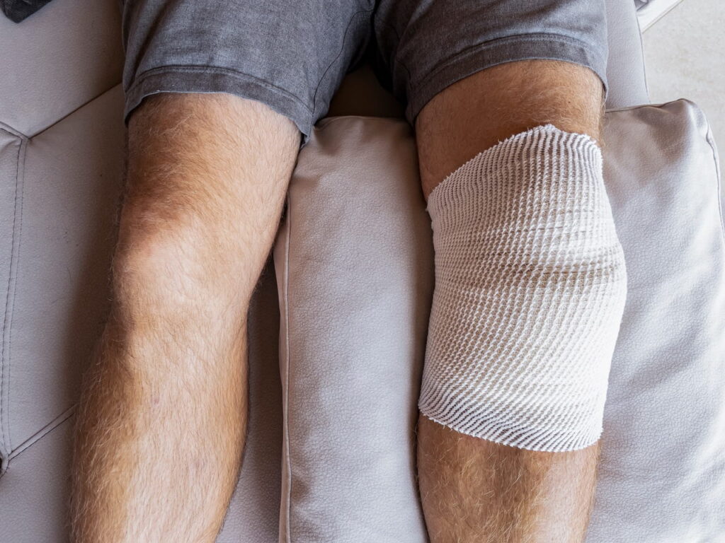 Close up of a man's legs with surgical dressing over his left knee