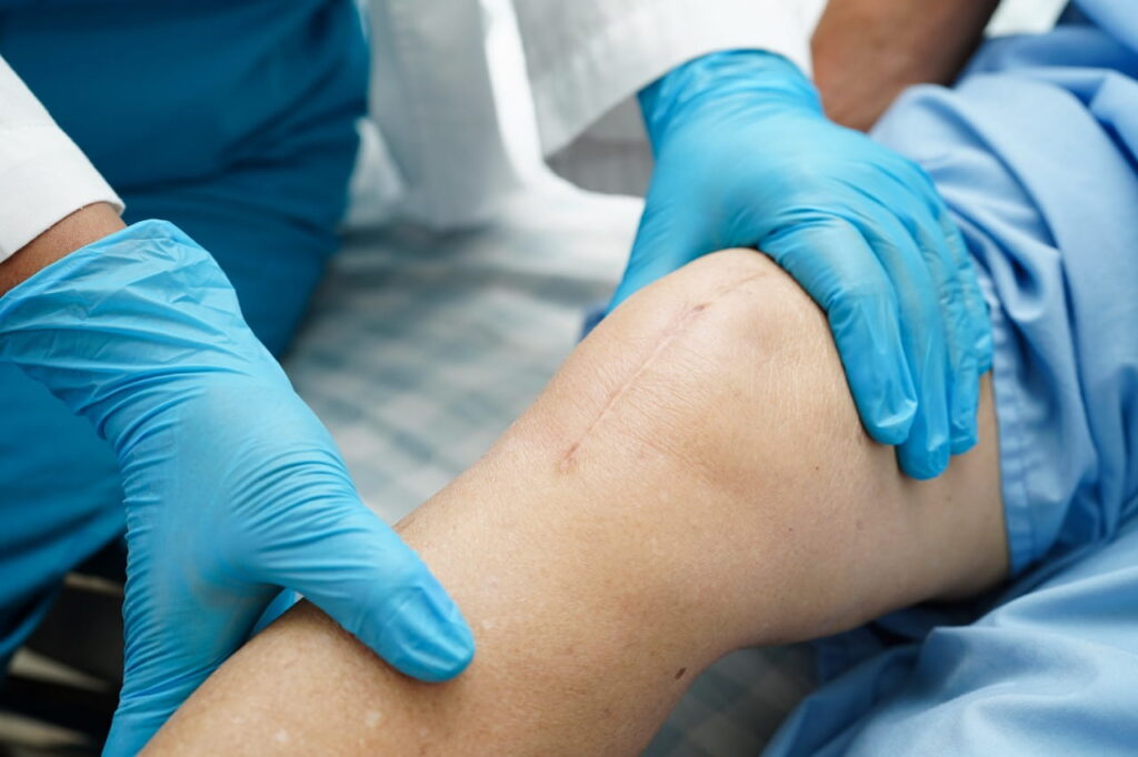 Close up of doctor assessing knee replacement scar on a patient's right leg