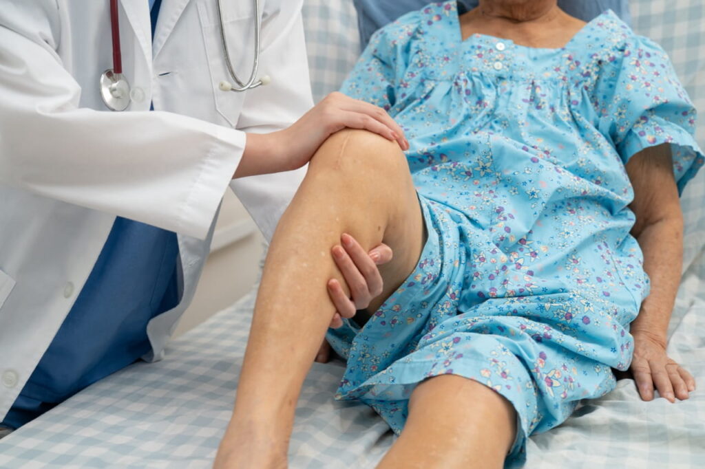 Doctor evaluating a patient as he bends her knee